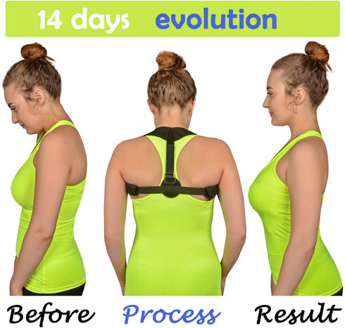 Back Brace Posture Corrector for Women and Men
